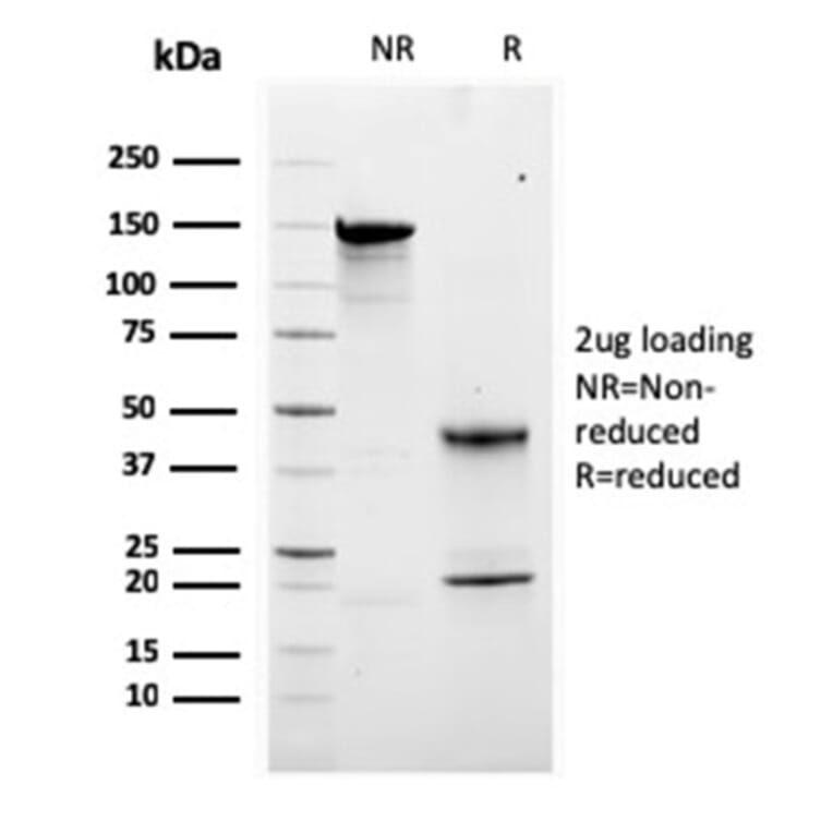 SDS-PAGE - Anti-Calretinin Antibody [CALB2/2807] - BSA and Azide free (A253556) - Antibodies.com