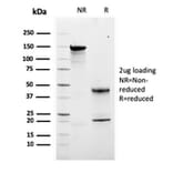 SDS-PAGE - Anti-Calretinin Antibody [CALB2/2807] - BSA and Azide free (A253556) - Antibodies.com