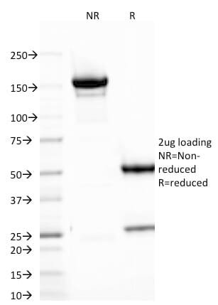 SDS-PAGE analysis of Anti-B7H4 Antibody [B7H4/1788] under non-reduced and reduced conditions; showing intact IgG and intact heavy and light chains, respectively. SDS-PAGE analysis confirms the integrity and purity of the antibody.