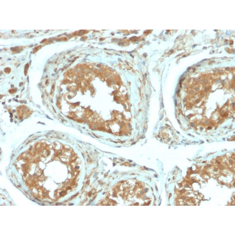 Immunohistochemistry - Anti-B7H4 Antibody [B7H4/2652R] - BSA and Azide free (A253558) - Antibodies.com