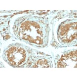 Immunohistochemistry - Anti-B7H4 Antibody [B7H4/2652R] - BSA and Azide free (A253558) - Antibodies.com