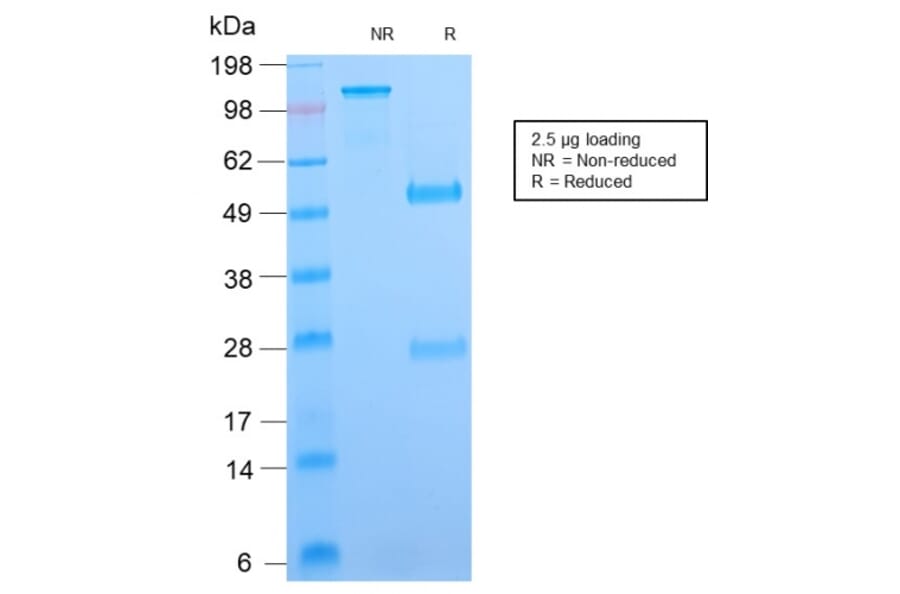SDS-PAGE - Anti-B7H4 Antibody [B7H4/2652R] - BSA and Azide free (A253558) - Antibodies.com