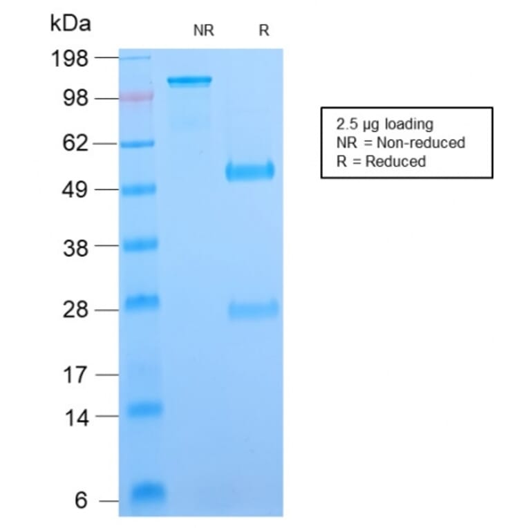 SDS-PAGE - Anti-B7H4 Antibody [B7H4/2652R] - BSA and Azide free (A253558) - Antibodies.com