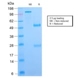 SDS-PAGE - Anti-B7H4 Antibody [B7H4/2652R] - BSA and Azide free (A253558) - Antibodies.com