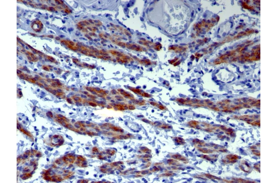 Immunohistochemistry - Anti-Caldesmon Antibody [h-CALD] - BSA and Azide free (A253559) - Antibodies.com