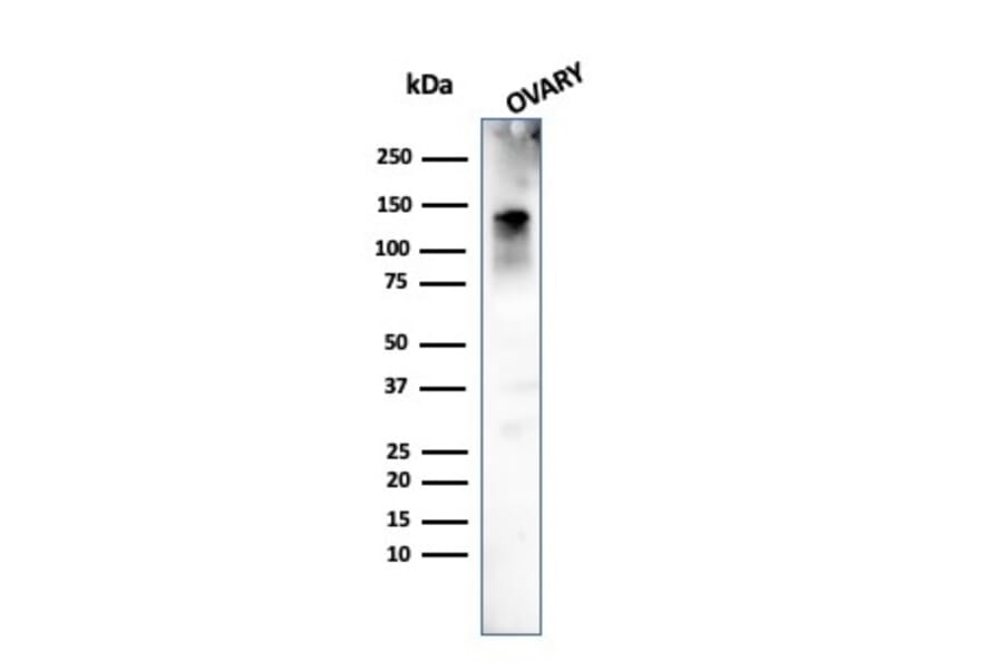 Western Blot - Anti-Caldesmon Antibody [h-CALD] - BSA and Azide free (A253560) - Antibodies.com