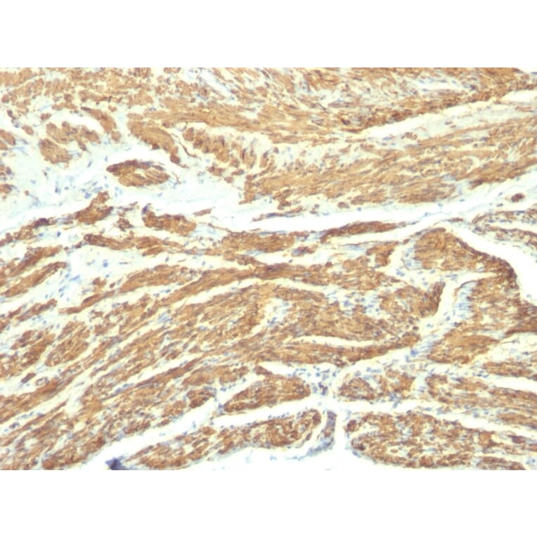 Immunohistochemistry - Anti-Caldesmon Antibody [SPM168] - BSA and Azide free (A253560) - Antibodies.com