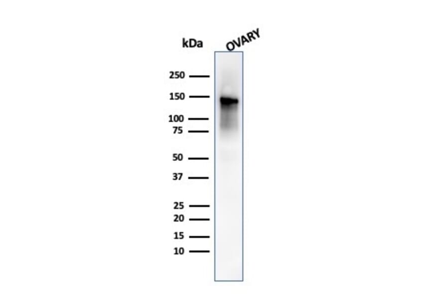 Western Blot - Anti-Caldesmon Antibody [SPM168] - BSA and Azide free (A253561) - Antibodies.com