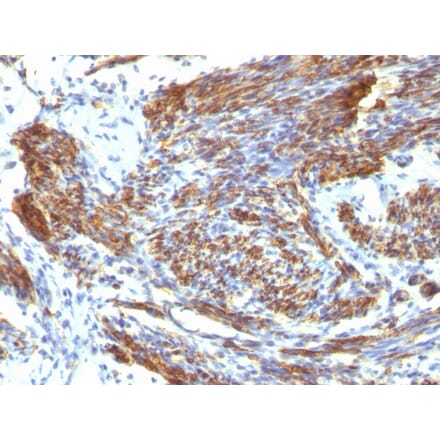 Immunohistochemistry - Anti-Caldesmon Antibody [CALD1/820] - BSA and Azide free (A253561) - Antibodies.com