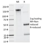 SDS-PAGE - Anti-Caldesmon Antibody [CALD1/820] - BSA and Azide free (A253562) - Antibodies.com