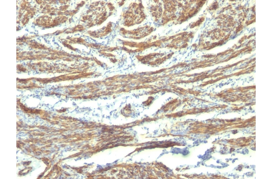 Immunohistochemistry - Anti-Caldesmon Antibody [CALD1/820 + h-CALD] - BSA and Azide free (A253562) - Antibodies.com