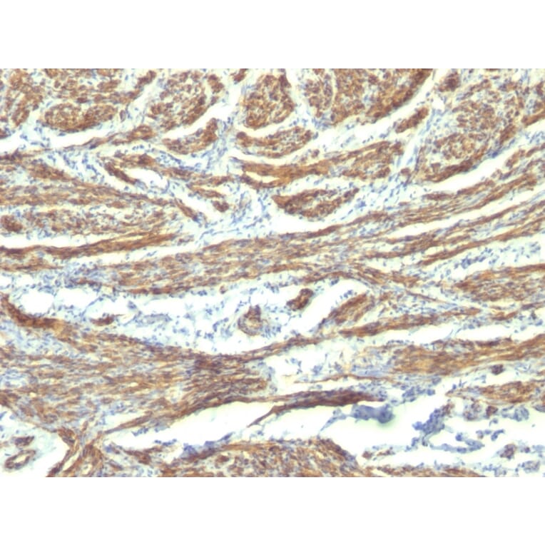 Immunohistochemistry - Anti-Caldesmon Antibody [CALD1/820 + h-CALD] - BSA and Azide free (A253562) - Antibodies.com