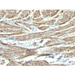 Immunohistochemistry - Anti-Caldesmon Antibody [CALD1/820 + h-CALD] - BSA and Azide free (A253562) - Antibodies.com
