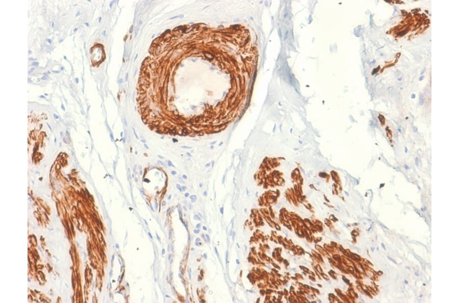 Immunohistochemistry - Anti-Caldesmon Antibody [rCALD1/820] - BSA and Azide free (A253563) - Antibodies.com