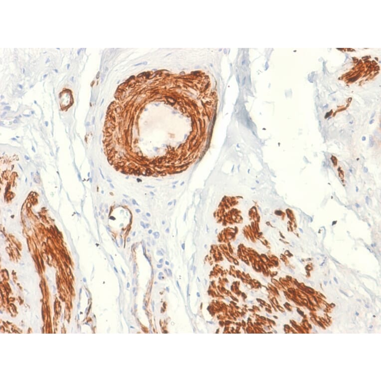 Immunohistochemistry - Anti-Caldesmon Antibody [rCALD1/820] - BSA and Azide free (A253563) - Antibodies.com