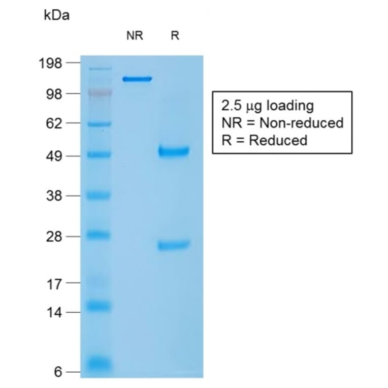 SDS-PAGE - Anti-Caldesmon Antibody [rCALD1/820] - BSA and Azide free (A253564) - Antibodies.com