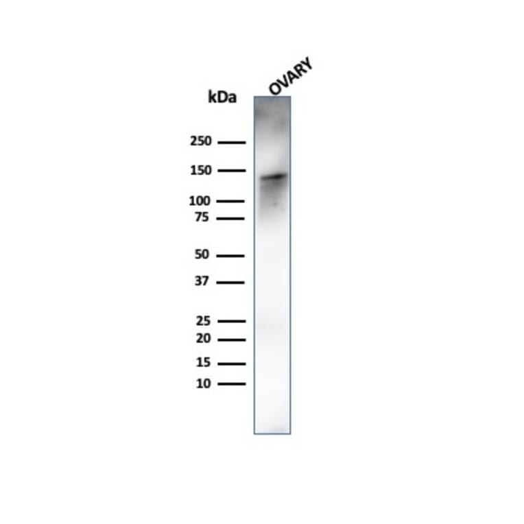 Western Blot - Anti-Caldesmon Antibody [rCALD1/820] - BSA and Azide free (A253564) - Antibodies.com