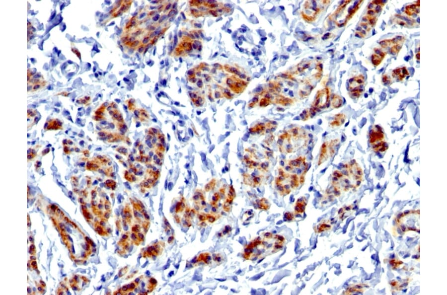 Immunohistochemistry - Anti-Caldesmon Antibody [CALD1/1424R] - BSA and Azide free (A253564) - Antibodies.com