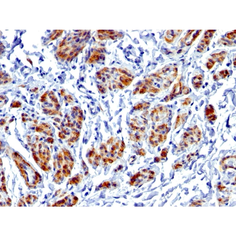 Immunohistochemistry - Anti-Caldesmon Antibody [CALD1/1424R] - BSA and Azide free (A253564) - Antibodies.com