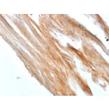 Immunohistochemistry - Anti-Caldesmon Antibody [CALD1/1424R] - BSA and Azide free (A253565) - Antibodies.com