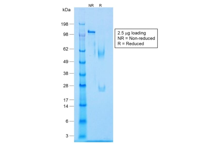 SDS-PAGE - Anti-Caldesmon Antibody [CALD1/1424R] - BSA and Azide free (A253565) - Antibodies.com