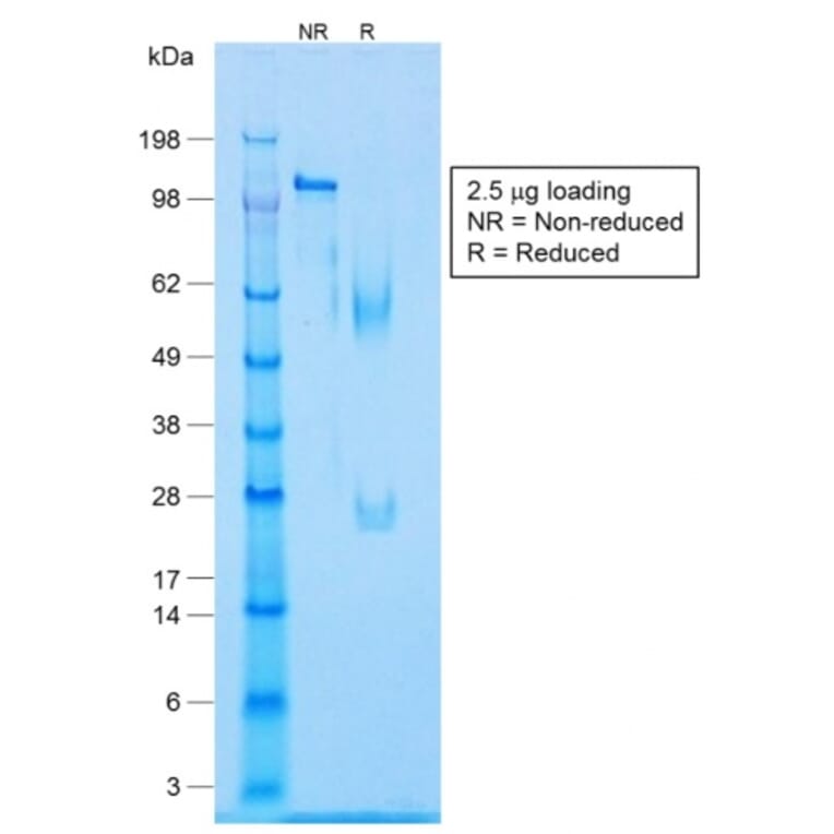 SDS-PAGE - Anti-Caldesmon Antibody [CALD1/1424R] - BSA and Azide free (A253565) - Antibodies.com