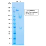 SDS-PAGE - Anti-Caldesmon Antibody [CALD1/1424R] - BSA and Azide free (A253565) - Antibodies.com