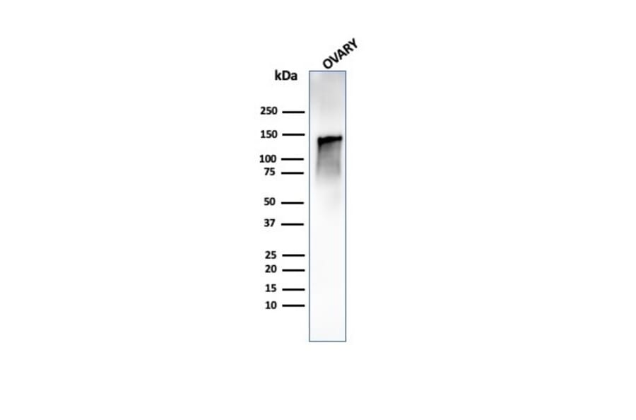 Western Blot - Anti-Caldesmon Antibody [CALD1/1424R] - BSA and Azide free (A253565) - Antibodies.com