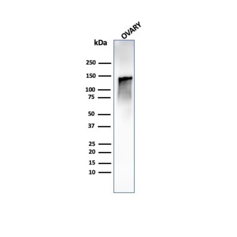 Western Blot - Anti-Caldesmon Antibody [CALD1/1424R] - BSA and Azide free (A253565) - Antibodies.com