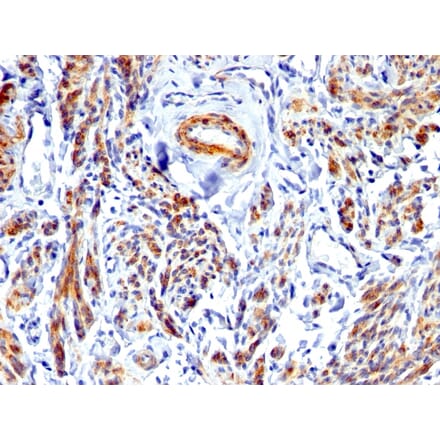 Immunohistochemistry - Anti-Caldesmon Antibody - BSA and Azide free (A253565) - Antibodies.com