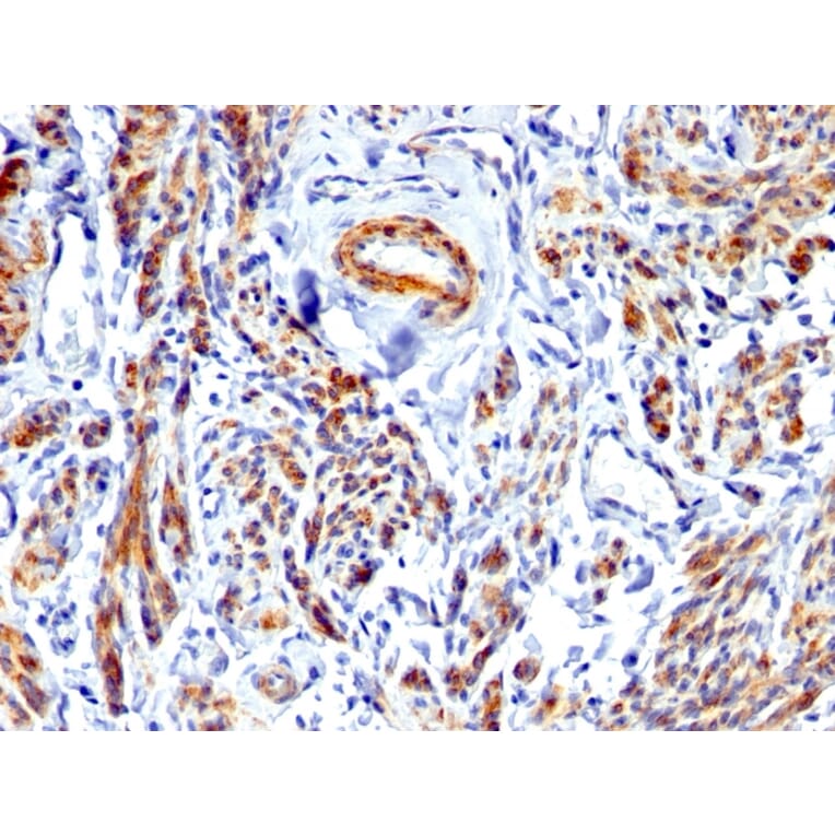 Immunohistochemistry - Anti-Caldesmon Antibody - BSA and Azide free (A253565) - Antibodies.com