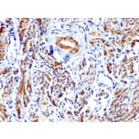 Immunohistochemistry - Anti-Caldesmon Antibody - BSA and Azide free (A253565) - Antibodies.com