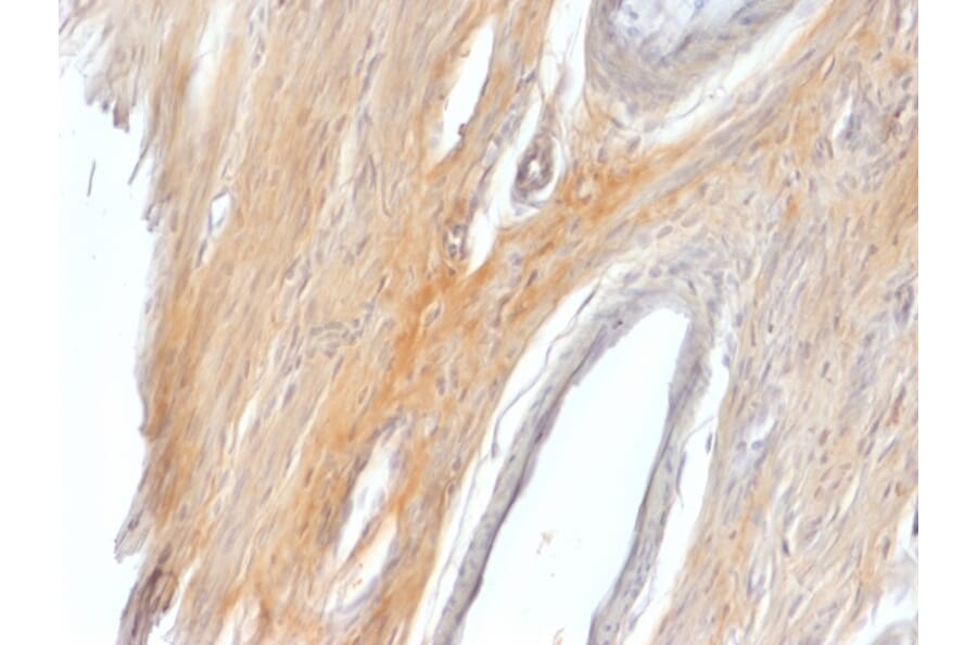 Immunohistochemistry - Anti-Caldesmon Antibody - BSA and Azide free (A253566) - Antibodies.com