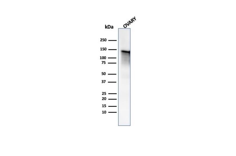 Western Blot - Anti-Caldesmon Antibody - BSA and Azide free (A253566) - Antibodies.com