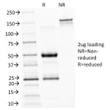 SDS-PAGE - Anti-ASRGL1 Antibody [CRASH/1289] - BSA and Azide free (A253567) - Antibodies.com
