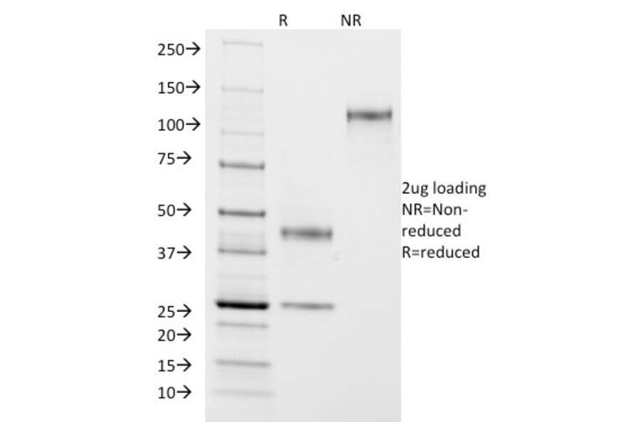 SDS-PAGE - Anti-ASRGL1 Antibody [CRASH/1290] - BSA and Azide free (A253567) - Antibodies.com