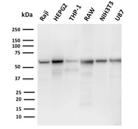 Western Blot - Anti-PD-L2 Antibody [PDL2/2676] - BSA and Azide free (A253570) - Antibodies.com