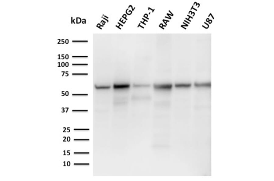 Western Blot - Anti-PD-L2 Antibody [PDL2/2676] - BSA and Azide free (A253570) - Antibodies.com
