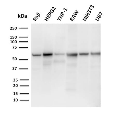 Western Blot - Anti-PD-L2 Antibody [PDL2/2676] - BSA and Azide free (A253570) - Antibodies.com