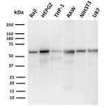 Western Blot - Anti-PD-L2 Antibody [PDL2/2676] - BSA and Azide free (A253570) - Antibodies.com