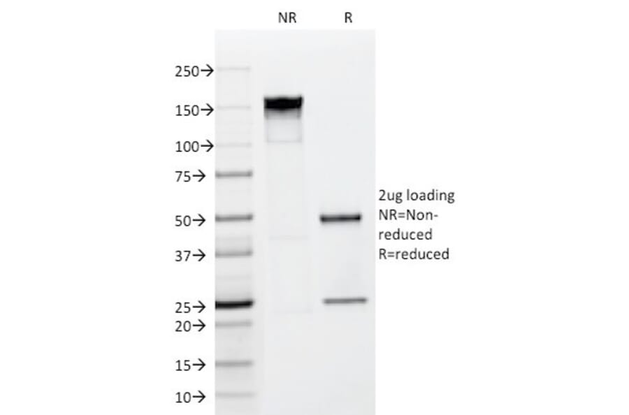 SDS-PAGE - Anti-FGF23 Antibody [FGF23/638] - BSA and Azide free (A253570) - Antibodies.com
