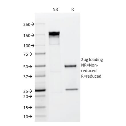 SDS-PAGE - Anti-FGF23 Antibody [FGF23/638] - BSA and Azide free (A253570) - Antibodies.com