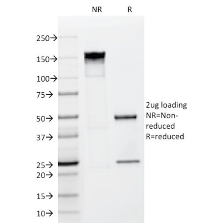 SDS-PAGE - Anti-FGF23 Antibody [FGF23/638] - BSA and Azide free (A253570) - Antibodies.com