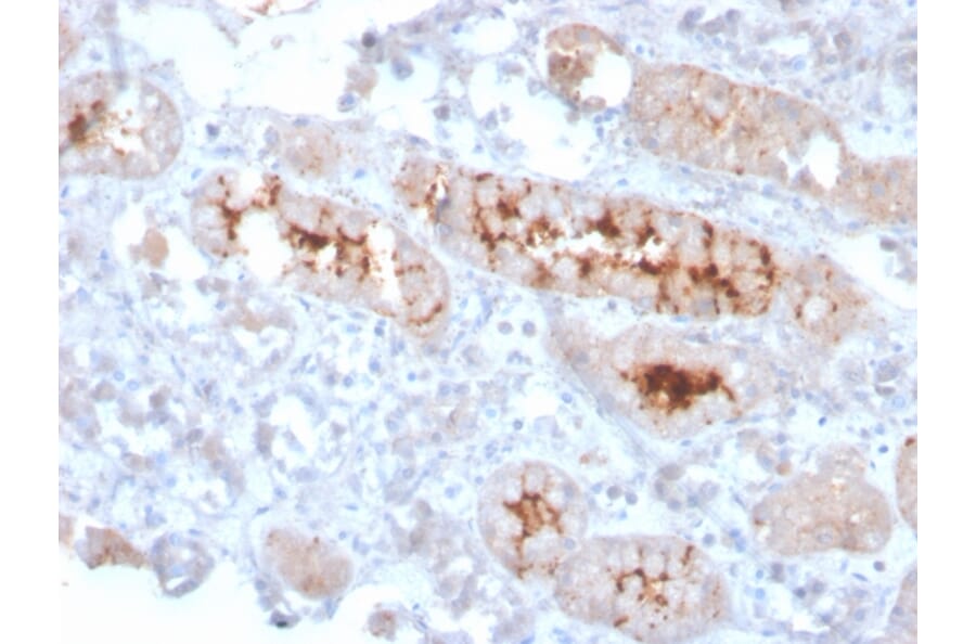 Immunohistochemistry - Anti-FGF23 Antibody [FGF23/4166] - BSA and Azide free (A253574) - Antibodies.com