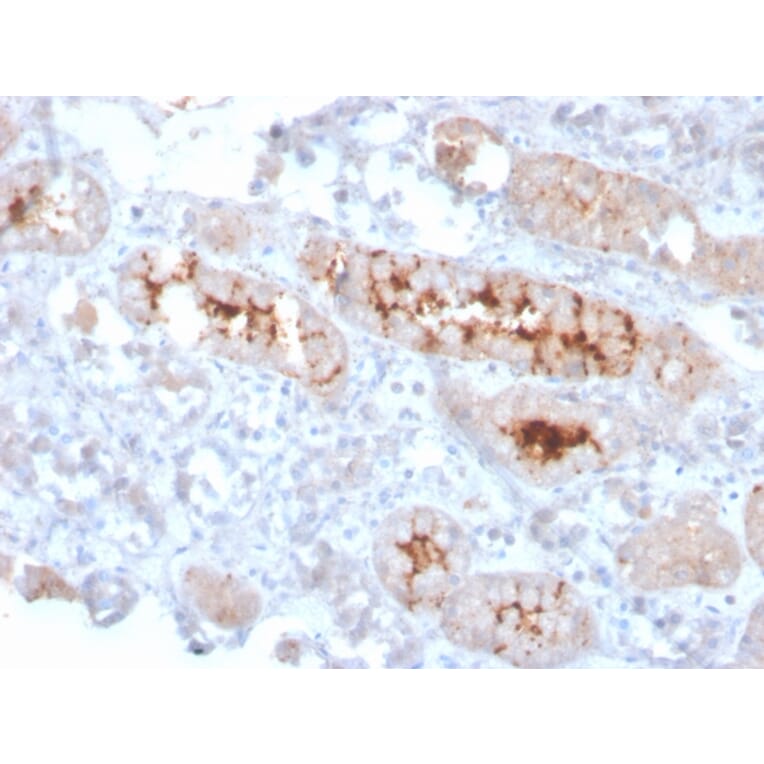 Immunohistochemistry - Anti-FGF23 Antibody [FGF23/4166] - BSA and Azide free (A253574) - Antibodies.com