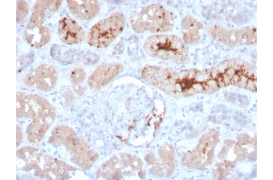 Immunohistochemistry - Anti-FGF23 Antibody [FGF23/4166] - BSA and Azide free (A253574) - Antibodies.com