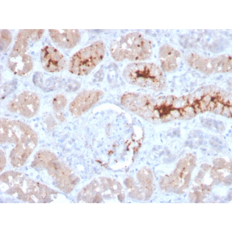 Immunohistochemistry - Anti-FGF23 Antibody [FGF23/4166] - BSA and Azide free (A253574) - Antibodies.com