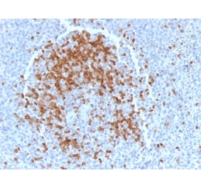 Immunohistochemistry - Anti-TCL1 Antibody [TCL1/2078] - BSA and Azide free (A253576) - Antibodies.com