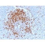 Immunohistochemistry - Anti-TCL1 Antibody [TCL1/2078] - BSA and Azide free (A253576) - Antibodies.com