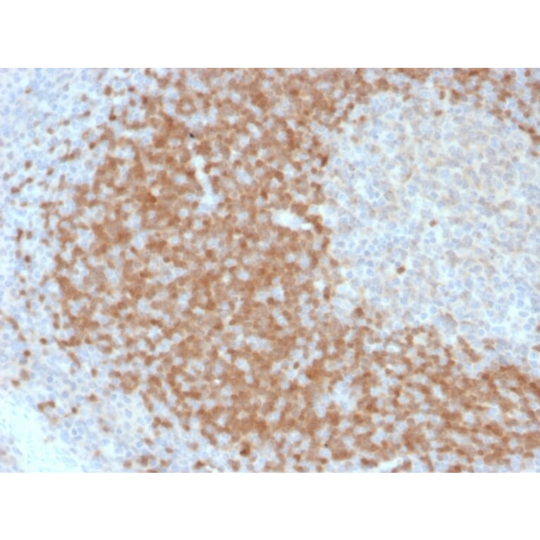 Immunohistochemistry - Anti-TCL1 Antibody [TCL1/2078] - BSA and Azide free (A253576) - Antibodies.com